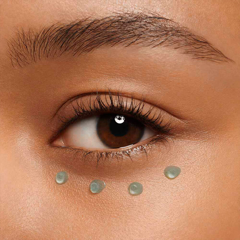 What causes dark circles and puffiness under the eyes? 
                                      